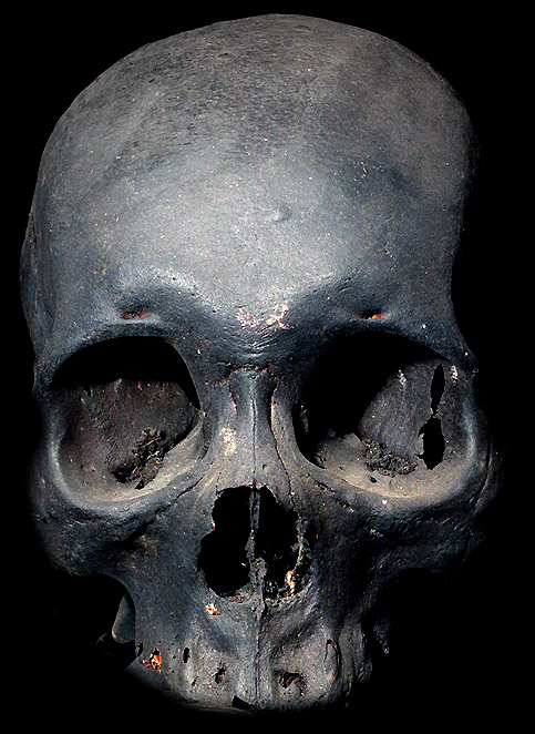 Head Hunting Victim Real Human Ifugao TrophySkull