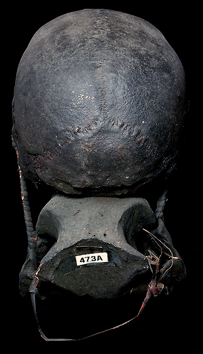 Ifugao Trophy Skull